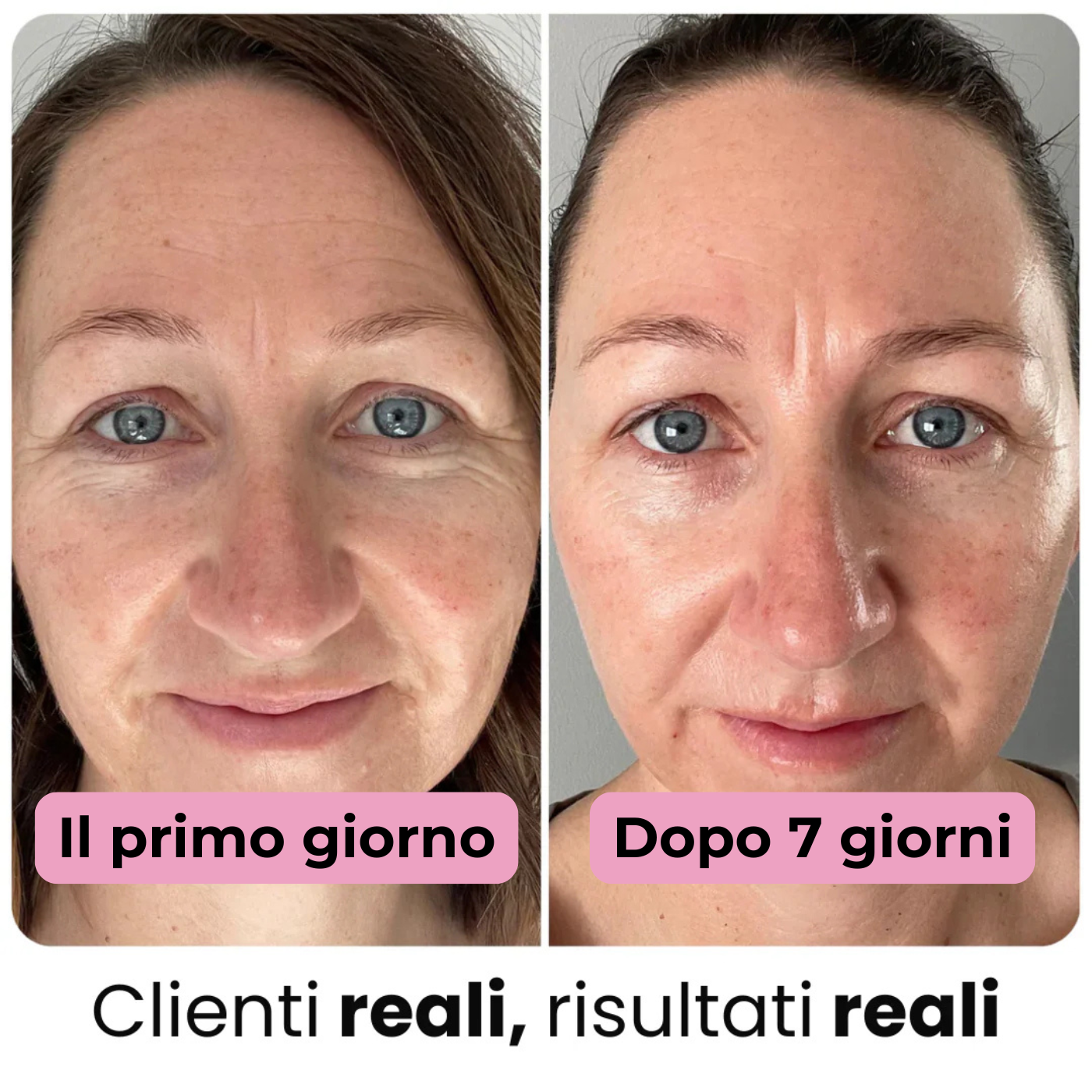 Kalis - Stick al Collagene Puro